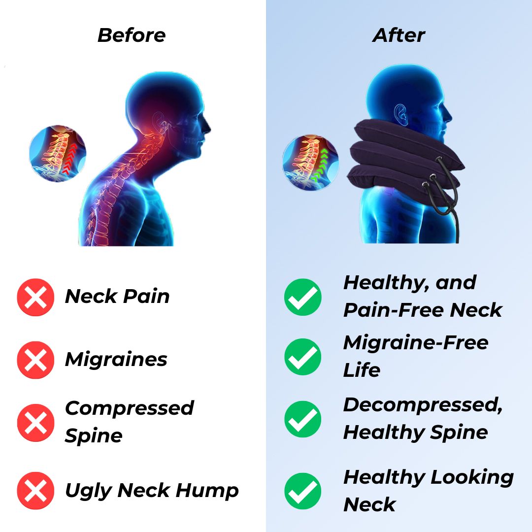 Dainely Neck Stretcher – Naturally Eliminate Neck Pain