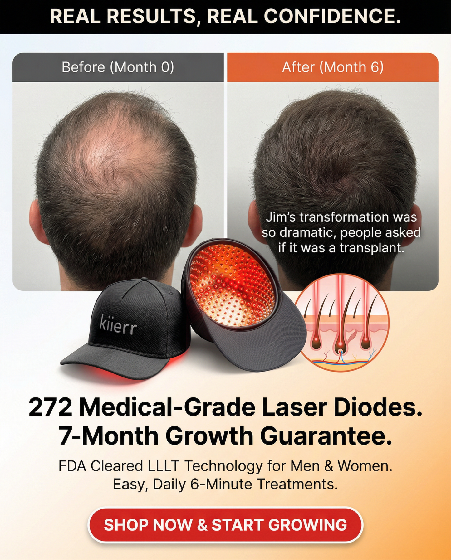 FolliGrow Reverse Hair Loss by Restoring Blood Flow & Energy to Your Follicles